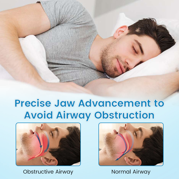 Slimoly™ | Anti-Snoring & Anti-Grinding Teeth Protector